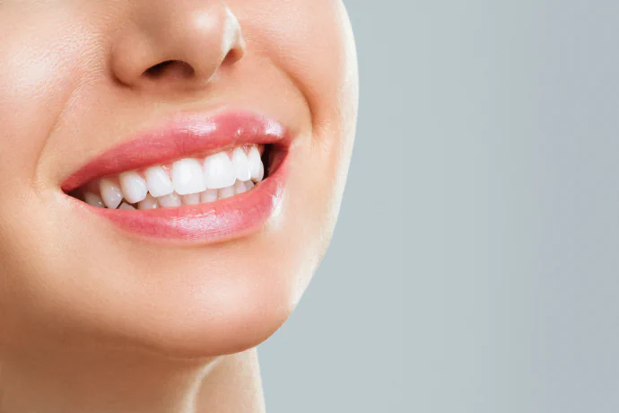 Smile Makeover