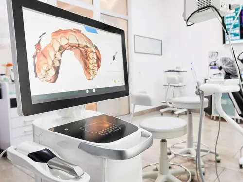 CEREC Scanner & Milling Unit in Panama City Beach, FL at West Bay Dental